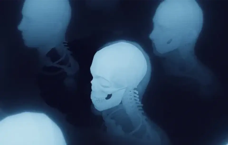 Skeleton Fluid Reveal — source preview
